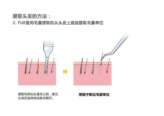 单面绣与膨松剂的工作原理一样吗