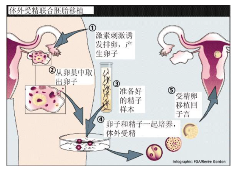 abo溶血是怎么了